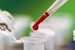 анализ крови