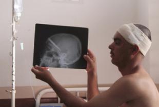 лезвие ножа в голове