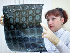 возраст мозга